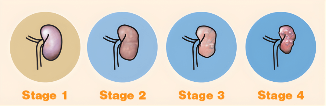 Liver Chemistry Profile